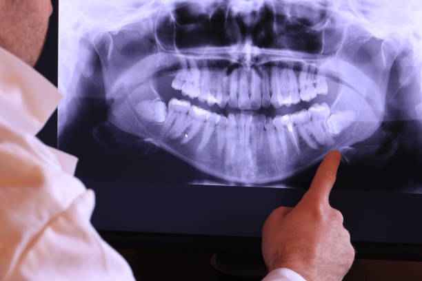 Best Emergency Gum Pain Relief  in Trappe, MD