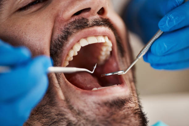 Best Root Canal Emergency Dentist  in Trappe, MD